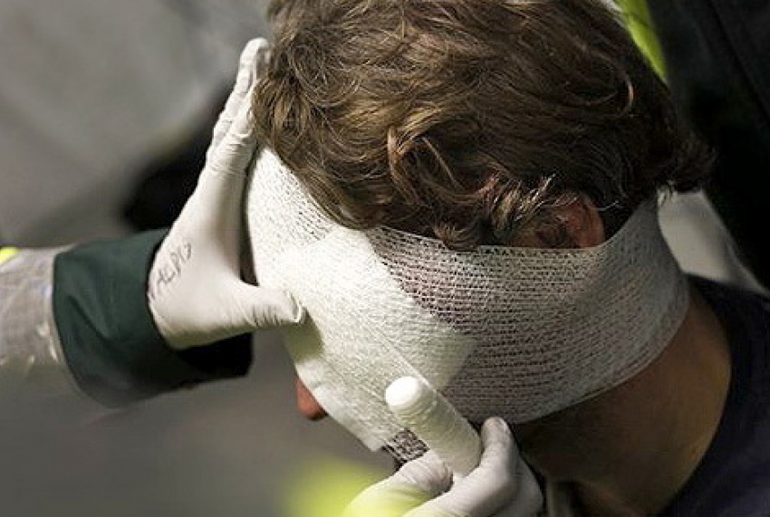 Под Волгоградом 28-летний парень разбил другу голову 