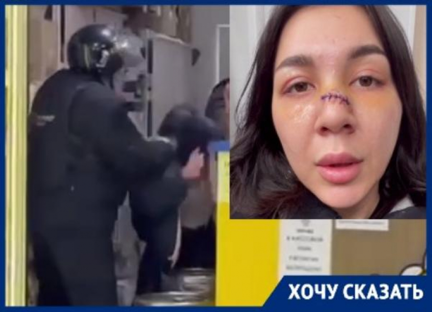 Волгоградка со сломанным носом обвинила охранника в избиение пивмаге