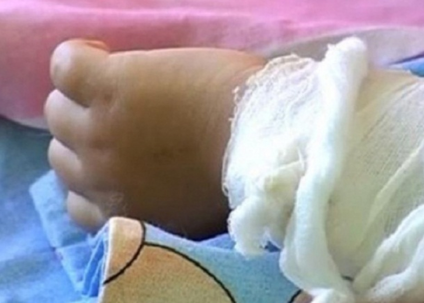В Волгограде ребенок из многодетной семьи второй раз за год обварился кипятком