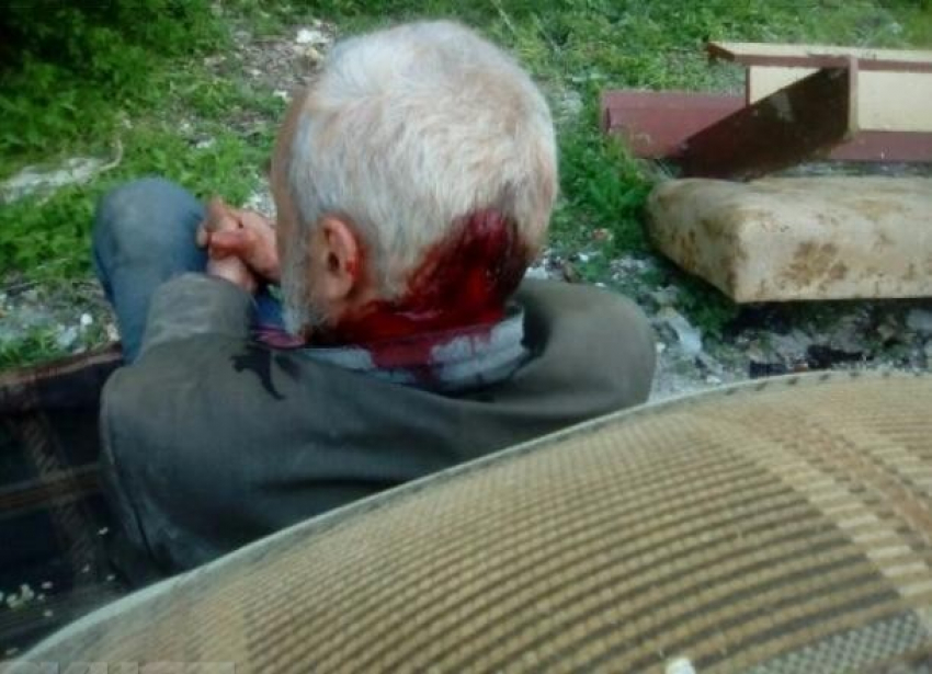 Пенсионера на костылях и с пробитой головой врачи выгнали из больницы на юге Волгограда