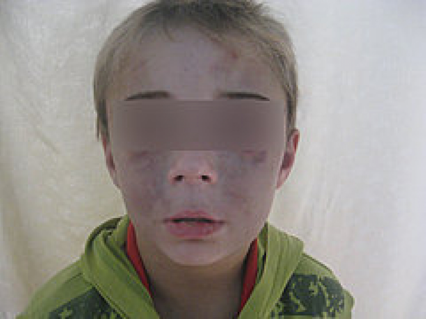 Под Волгоградом жестокий отчим за издевательства над ребенком сядет на 5 лет