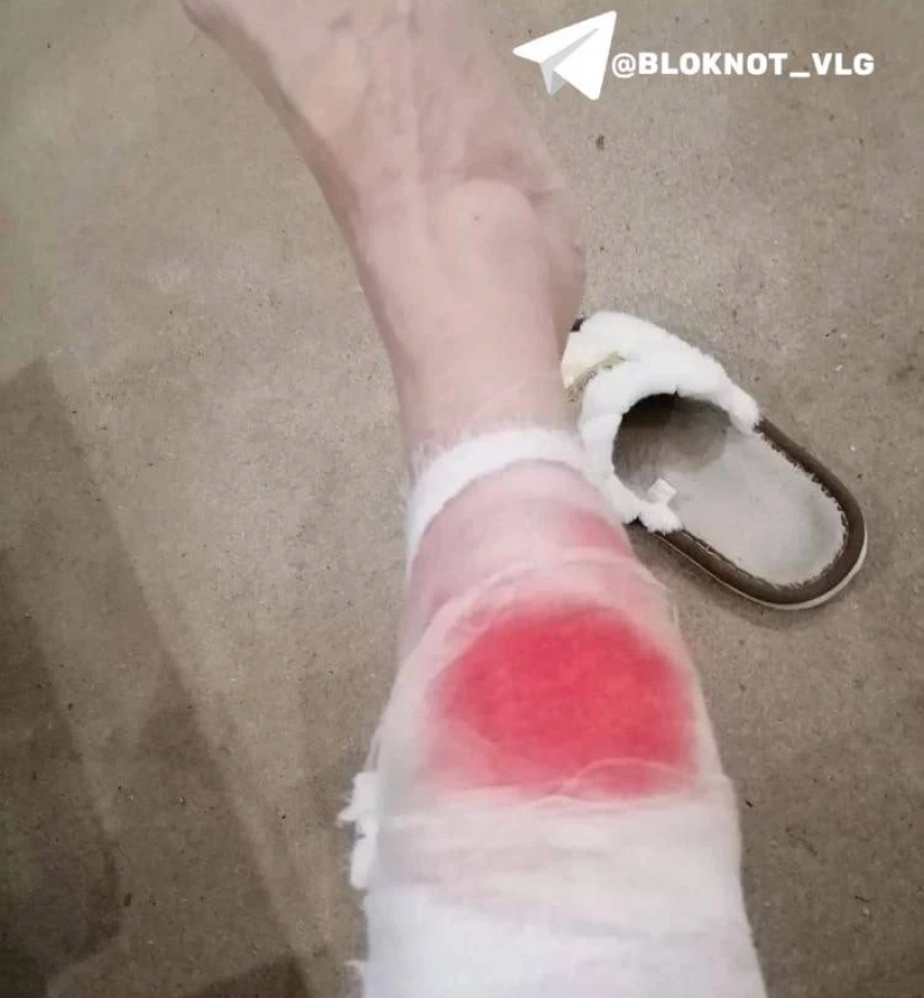 Агрессивная дворняга нашла жертву у волгоградской школы